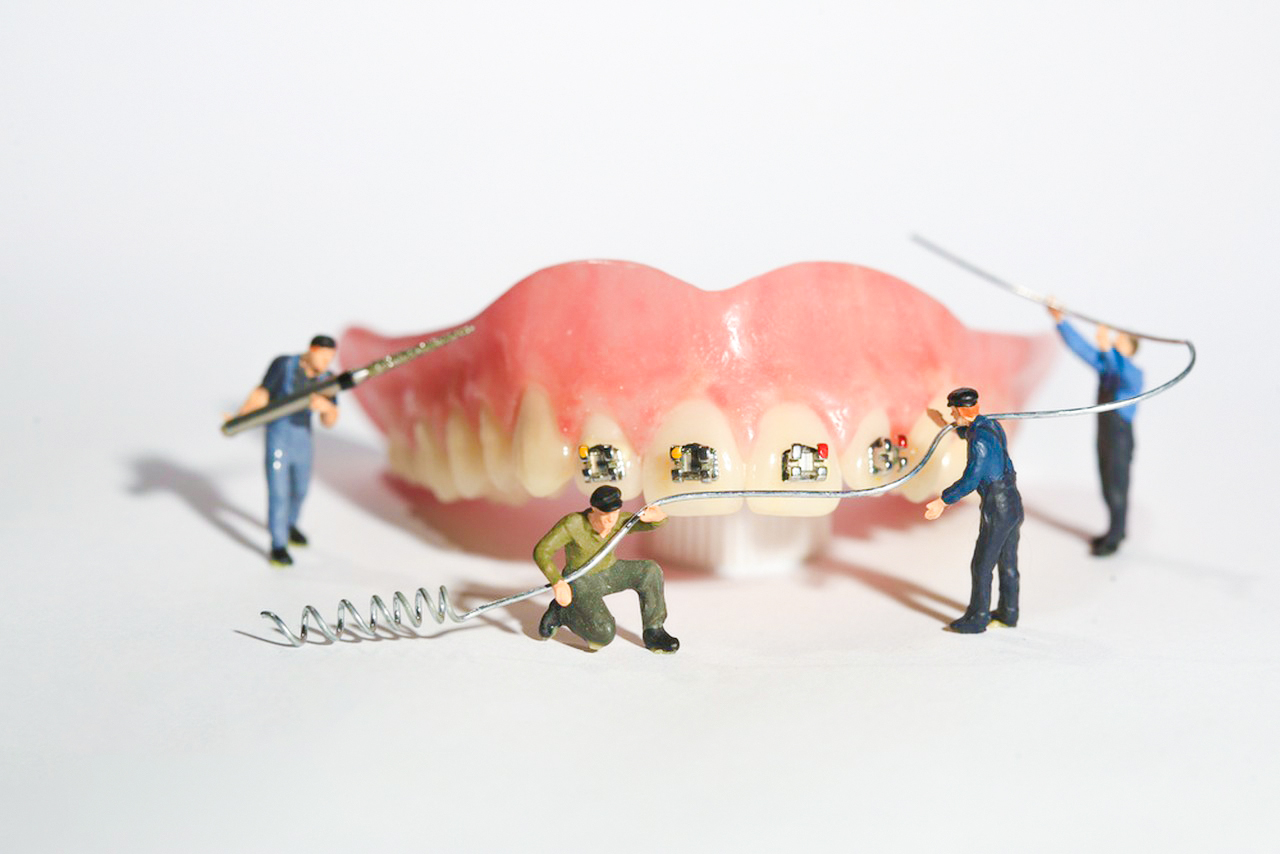 7种牙齿畸形，拉低颜值还危害健康